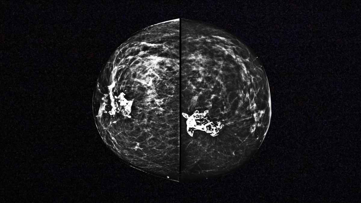 Las pruebas médicas que toda mujer debería hacerse a partir de los 50 años