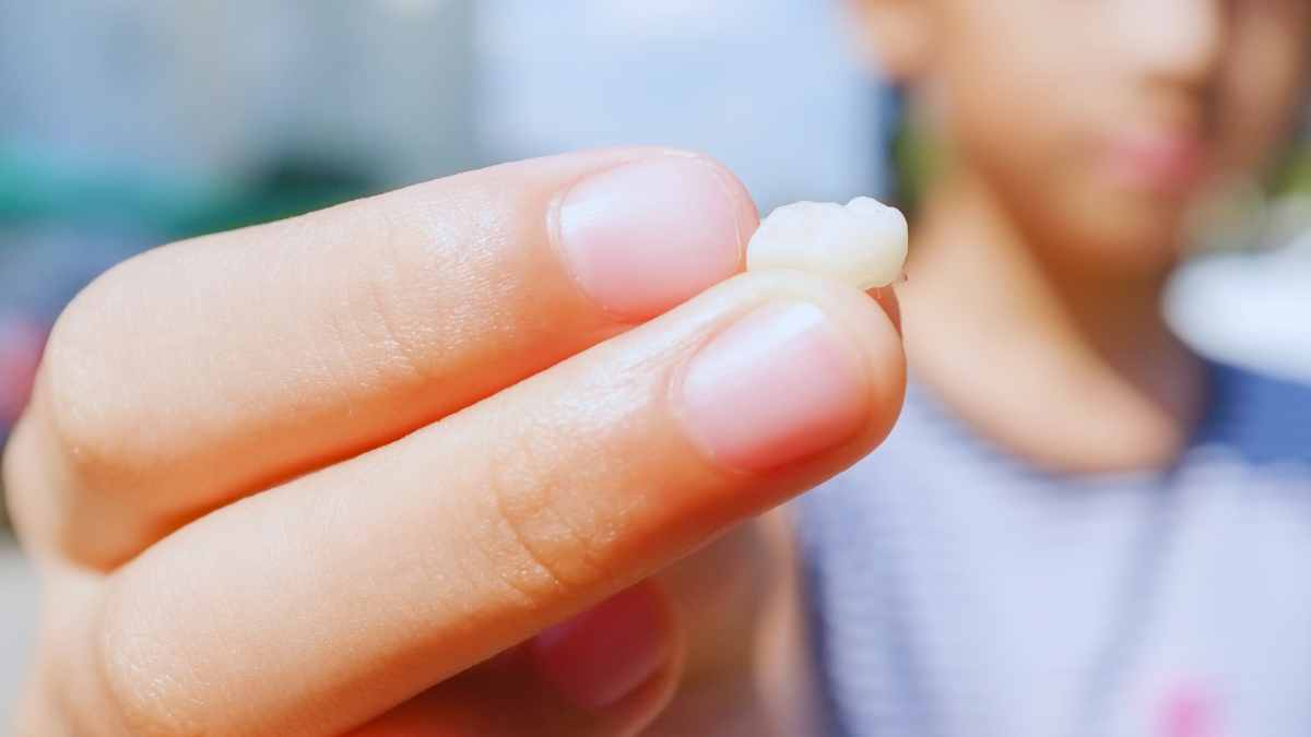 Significado de soñar con caída de dientes