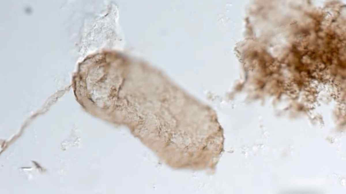 Microfósil de cianobacteria de 1.750 millones de años con tilacoides, precursor de la fotosíntesis oxigenada que llenó la atmósfera de oxígeno.