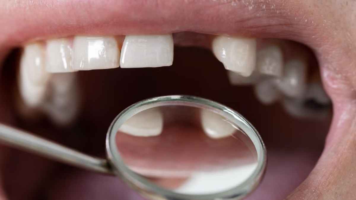 Crecen las esperanzas para regenerar dientes perdidos en adultos