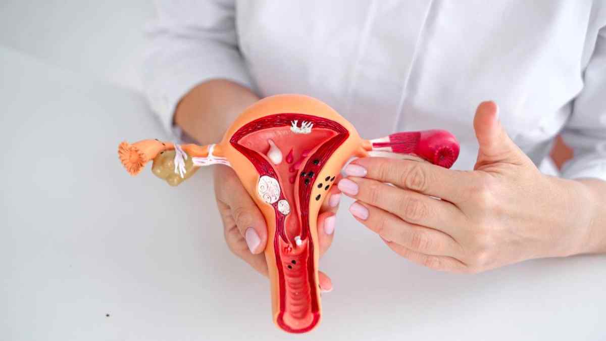 modelo anatómico de útero con lesiones de endometriosis sostenido por médica; concepto test rápido en compresa.