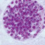 Quiste de Toxoplasma gondii al microscopio con numerosos parásitos internos.