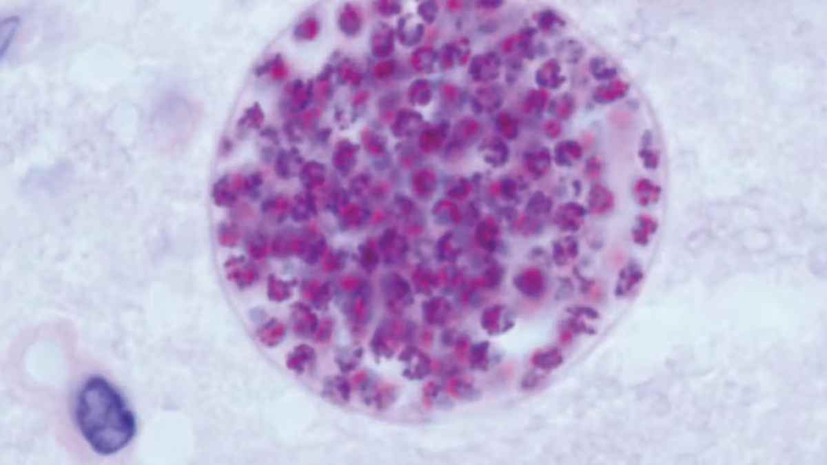 Así manipula Toxoplasma gondii a sus víctimas para llegar al estómago de un gato