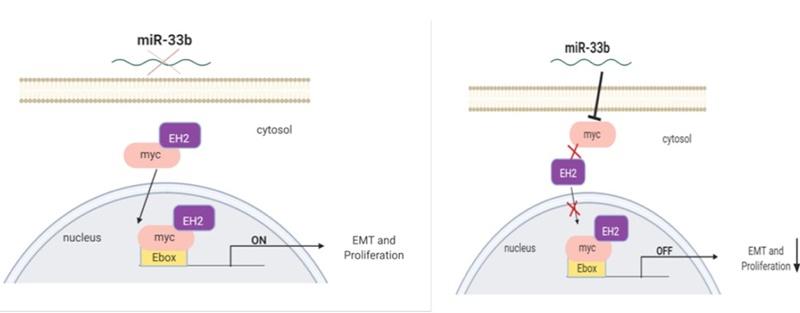 El mal pronóstico del cáncer de mama está en los genes El mal pronóstico del cáncer de mama está en los genes