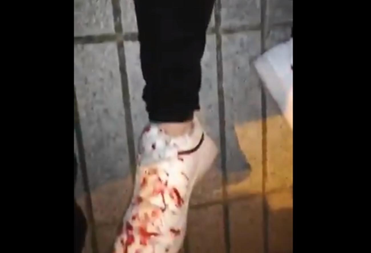 Joven herido en las protestas de Linares contra la agresión policial