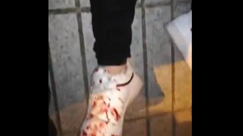 Joven herido en las protestas de Linares contra la agresión policial