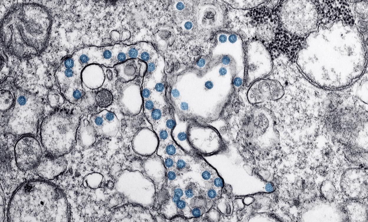 La vacuna del CSIC contra el coronavirus estará lista el primer trimestre de 2022