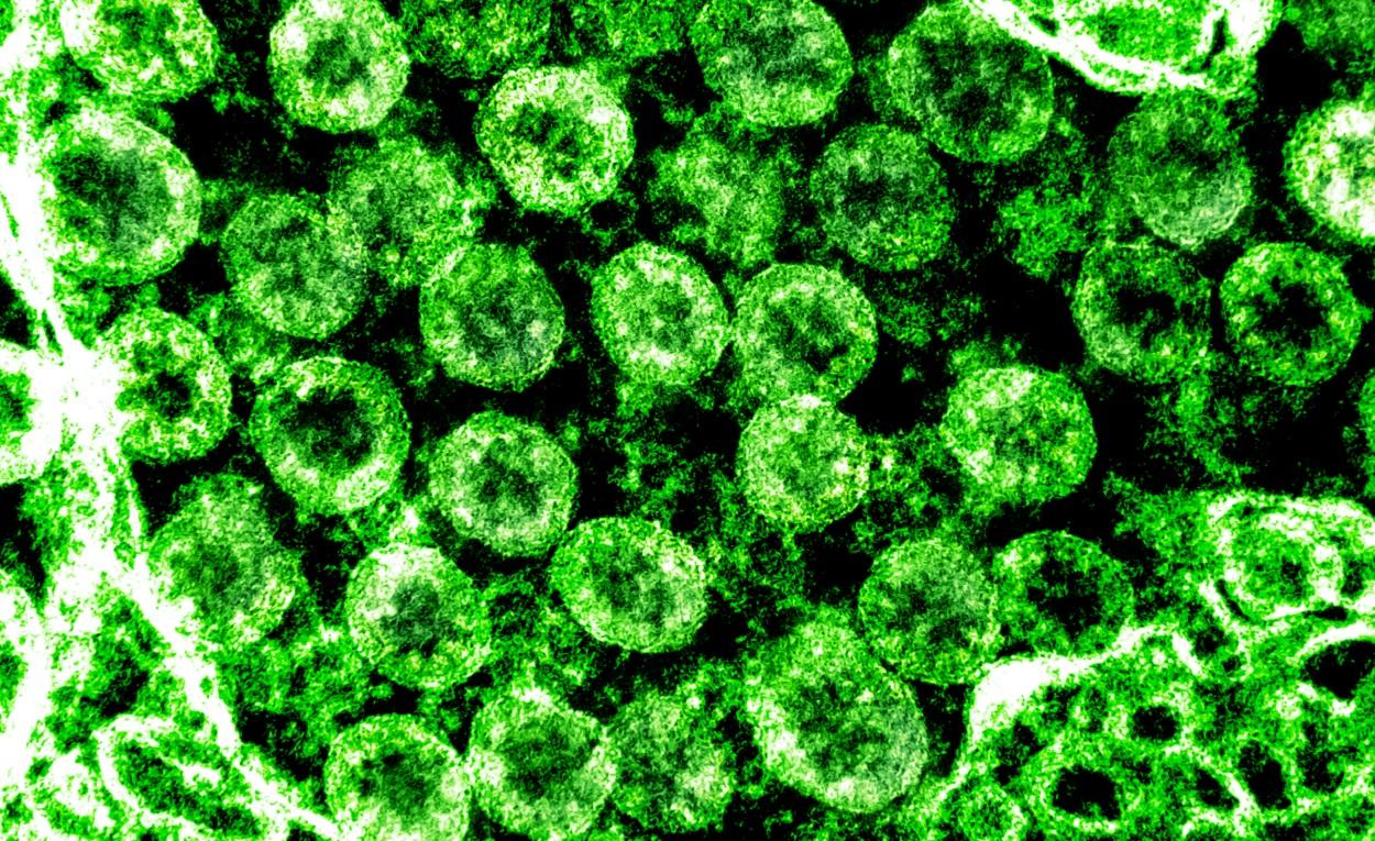 Micrografía electrónica de transmisión de partículas del virus SARS CoV 2, aislada de un paciente. NIAID