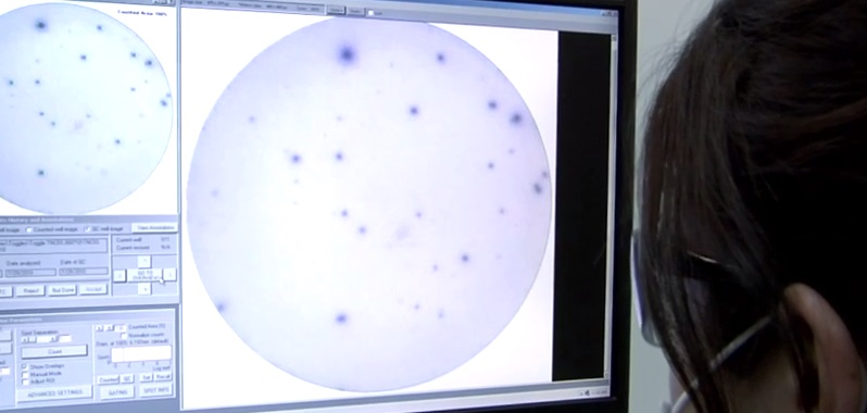 La investigación médica y científica es fundamental en la lucha contra el cáncer La investigación médica y científica es fundamental en la lucha contra el cáncer