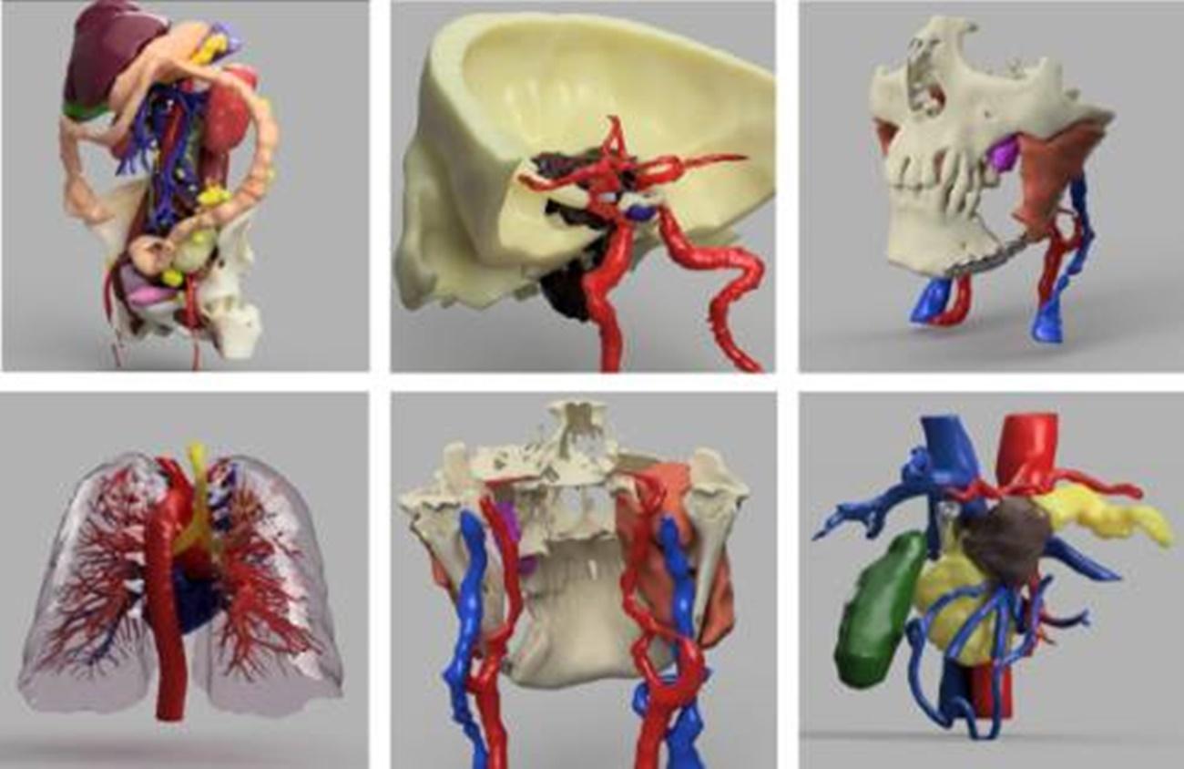 La planificación quirúrgica 3D presenta numerosas ventajas, tanto para los médicos como para los pacientes. (Fuente: Quirónsalud)
