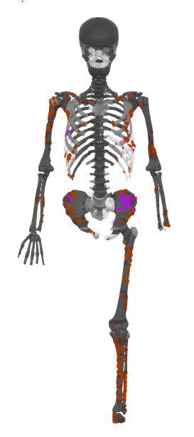 REconstrucción del ataque de un tiburón hace 3000 años ©Universidad de Oxford