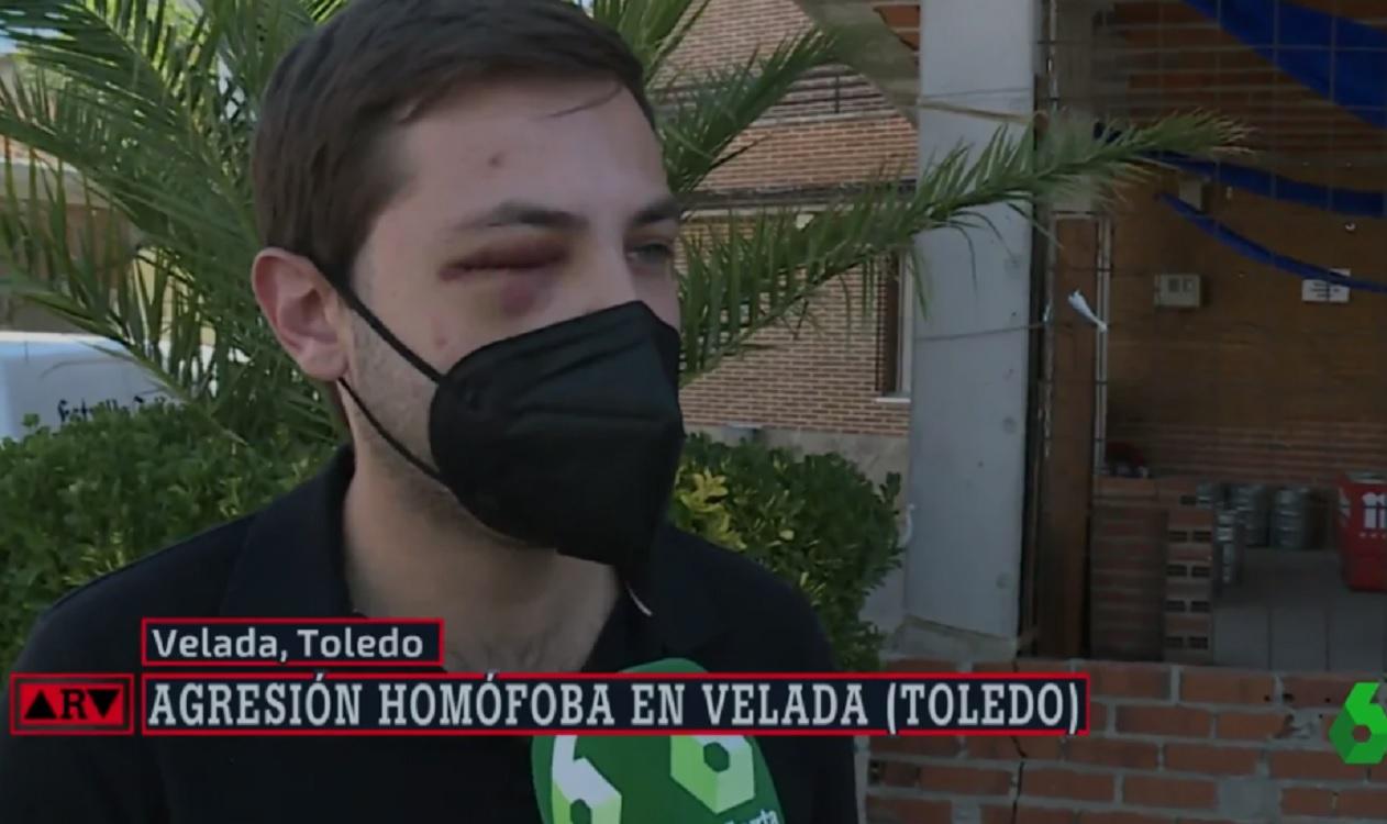 Miguel Ángel, víctima de una agresión homófoba en Toledo. Fuente La Sexta