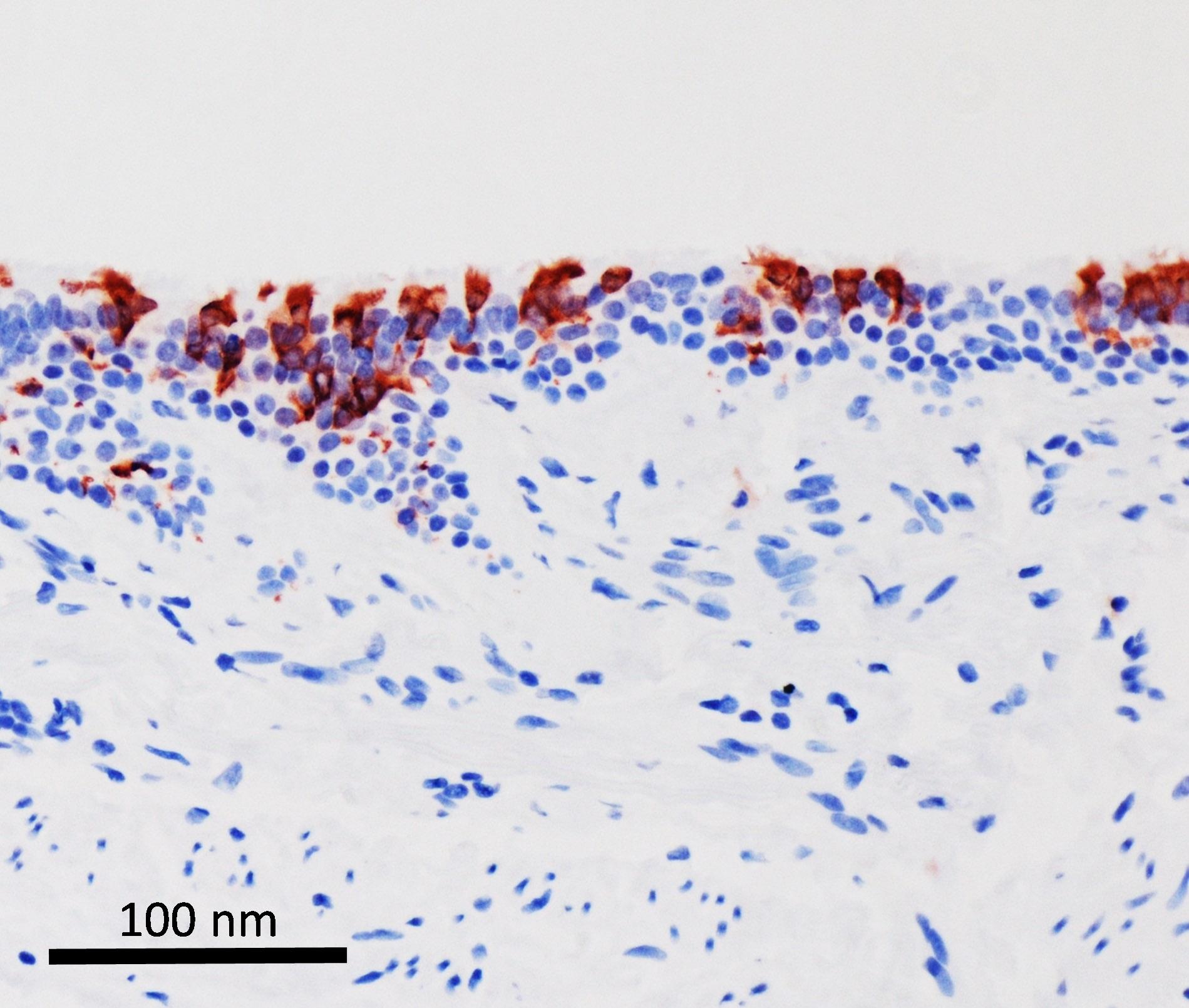 La variante omicrón del SARS-CoV-2 (en rojo) infectando tejidos de bronquios humanos.