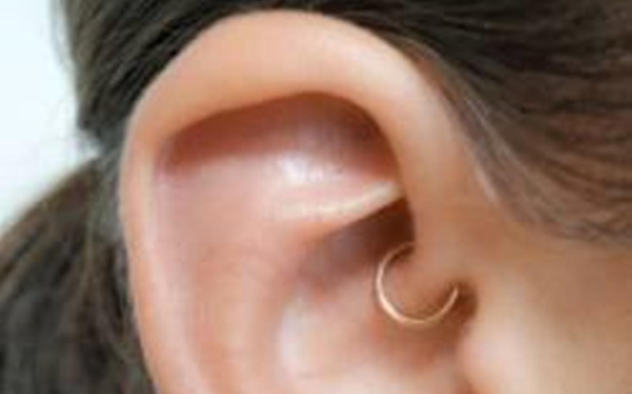 El daith piercing empezó a ponerse de moda en 2015 como terapia alternativa para tratar la migraña. (Foto: Cefablog Quirónsalud)