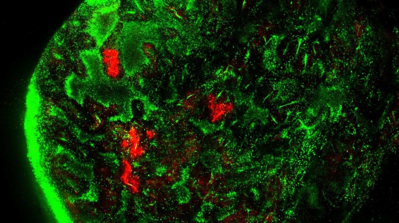 PADME fotoconversión de verde a rojo en las áreas de interés en un tumor de ratón