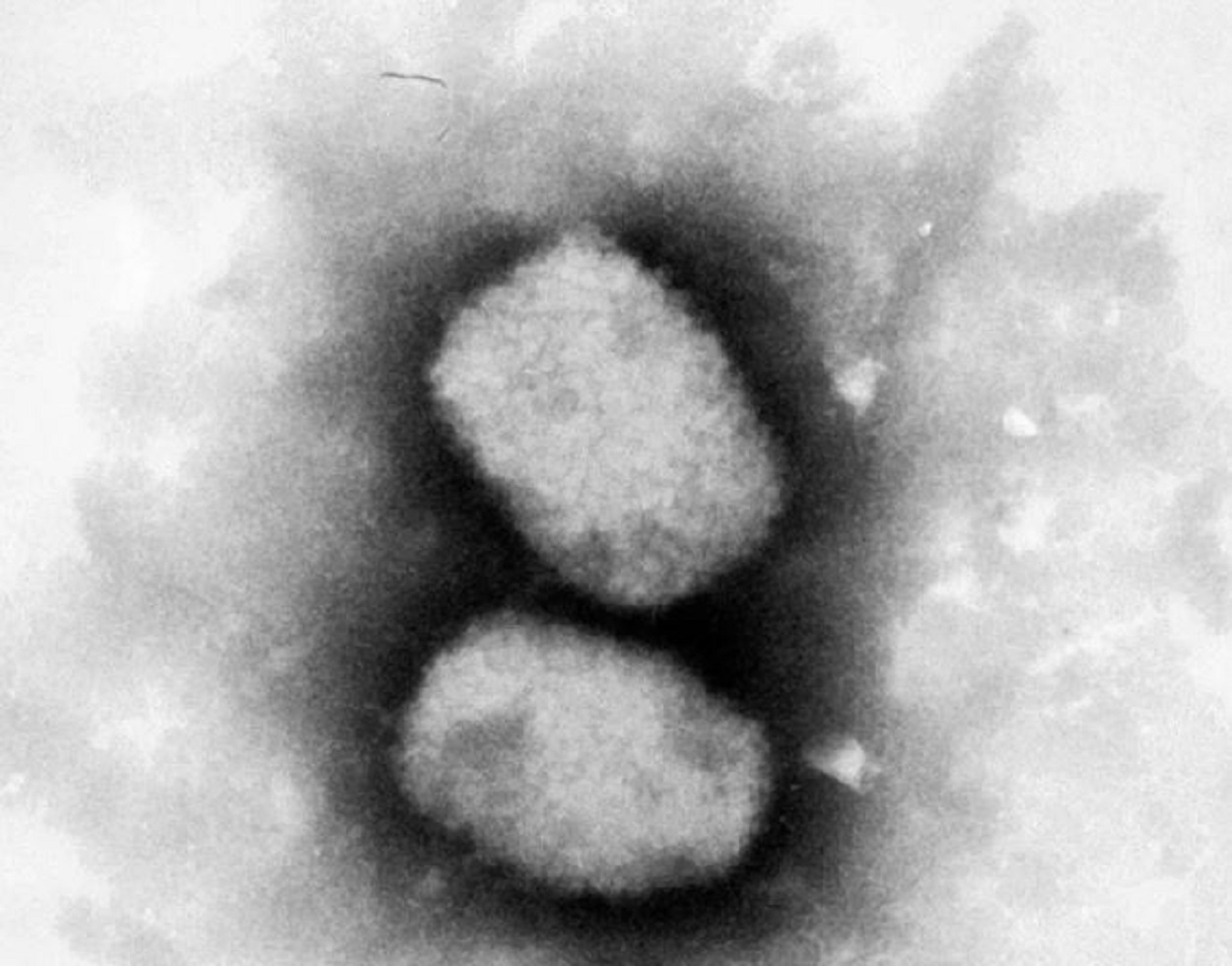  El virus de la viruela del mono. Fuente: Europa Press.