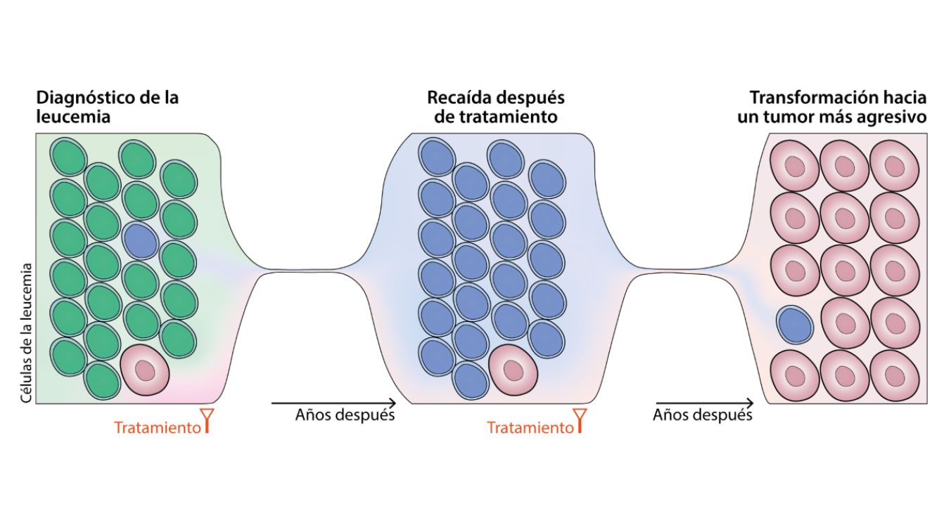 Esquema de la evolución de la leucemia hacia un tumor más agresivo