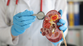 La enfermedad renal crónica es una epidemia silenciosa con un fuerte impacto en la población y de la que existe gran desconocimiento