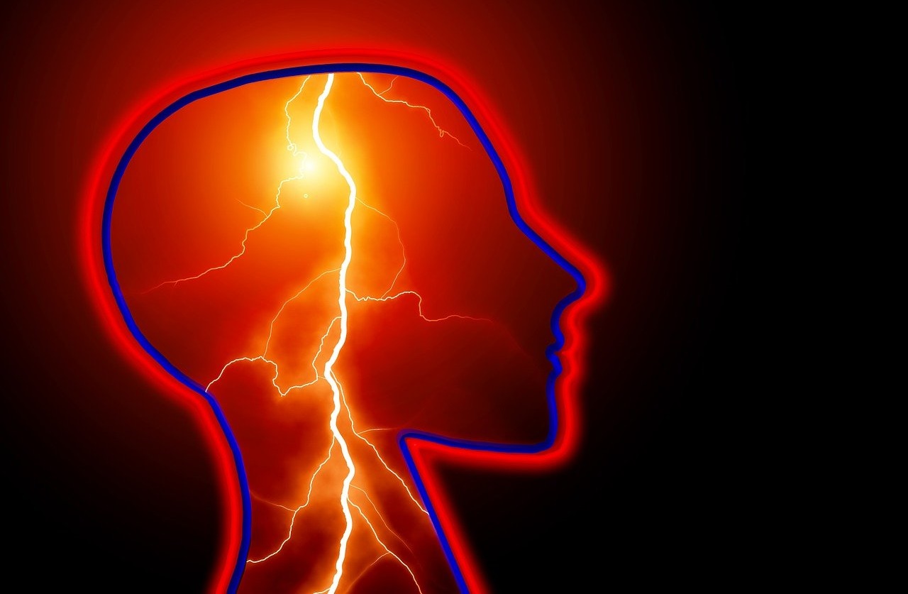 La epilepsia es una de las enfermedades neurológicas más comunes, pero no siempre es fácil de diagnosticar. (Foto: Pixabay) 