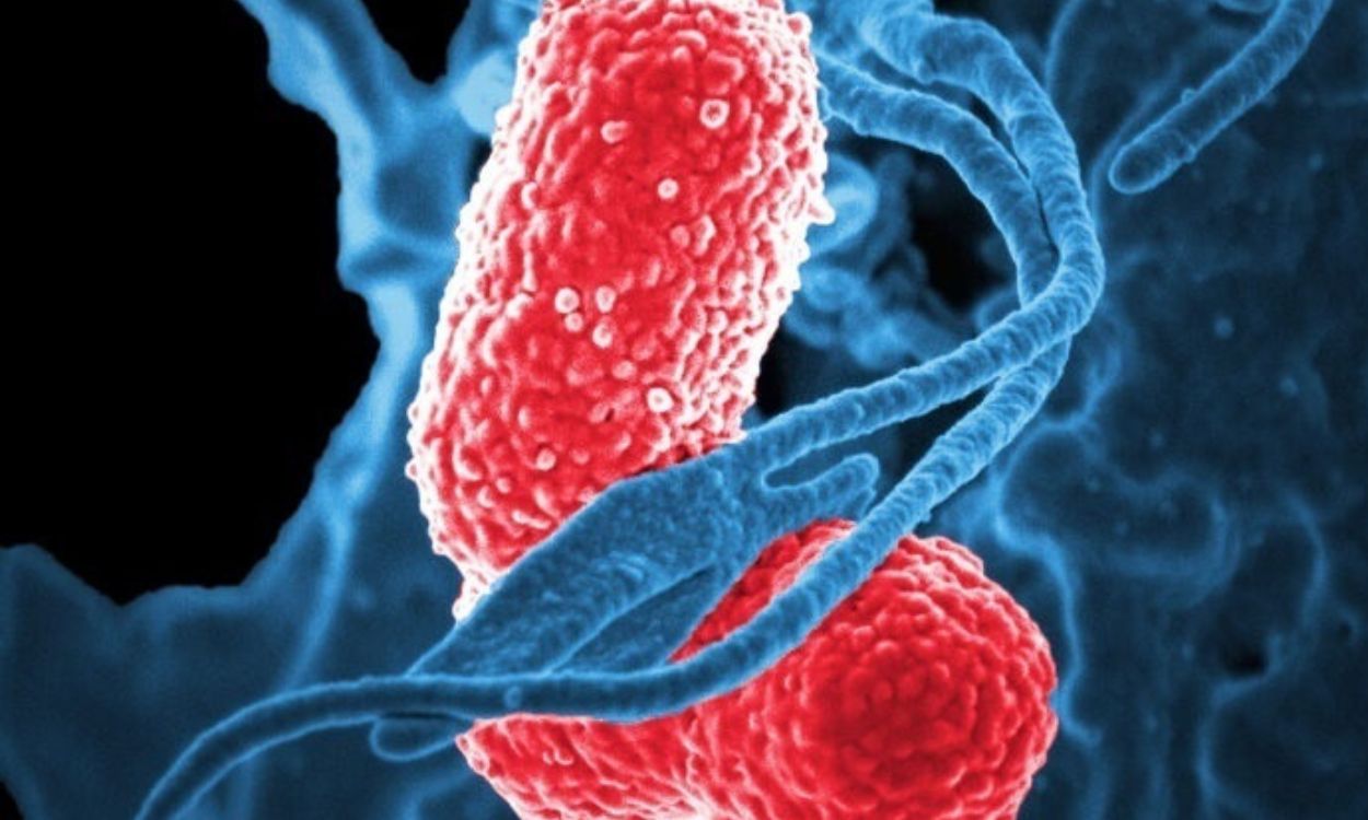 Los glóbulos blancos (azul) atacan a dos bacterias 'Klebsiella' (rosa). EP.