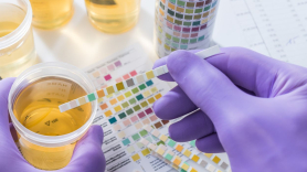 Análisis de orina: todo lo que sabe sobre tu salud