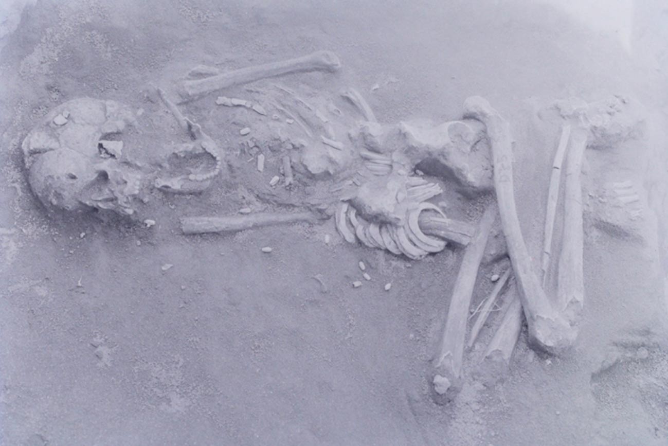 Fotografía de los antiguos restos humanos encontrados en las ruinas de Hirota con el cráneo deformado (Museo de la Universidad de Kyushu)