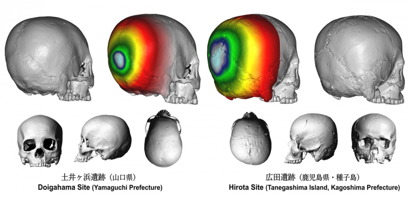 Imágenes 3D de cráneos deformados en el antiguo Japón