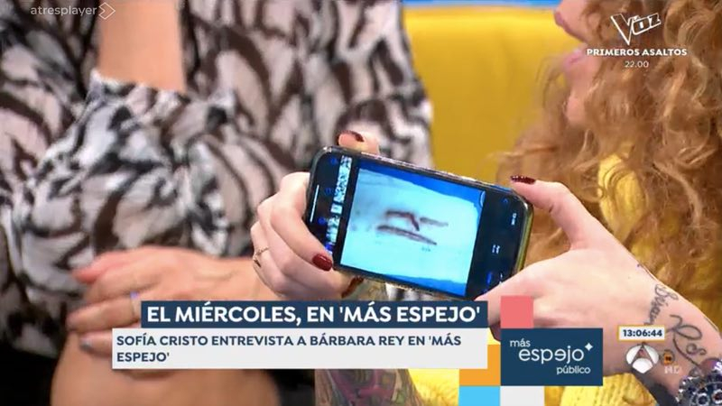 Los labios de Bárbara Rey Los labios de Bárbara Rey