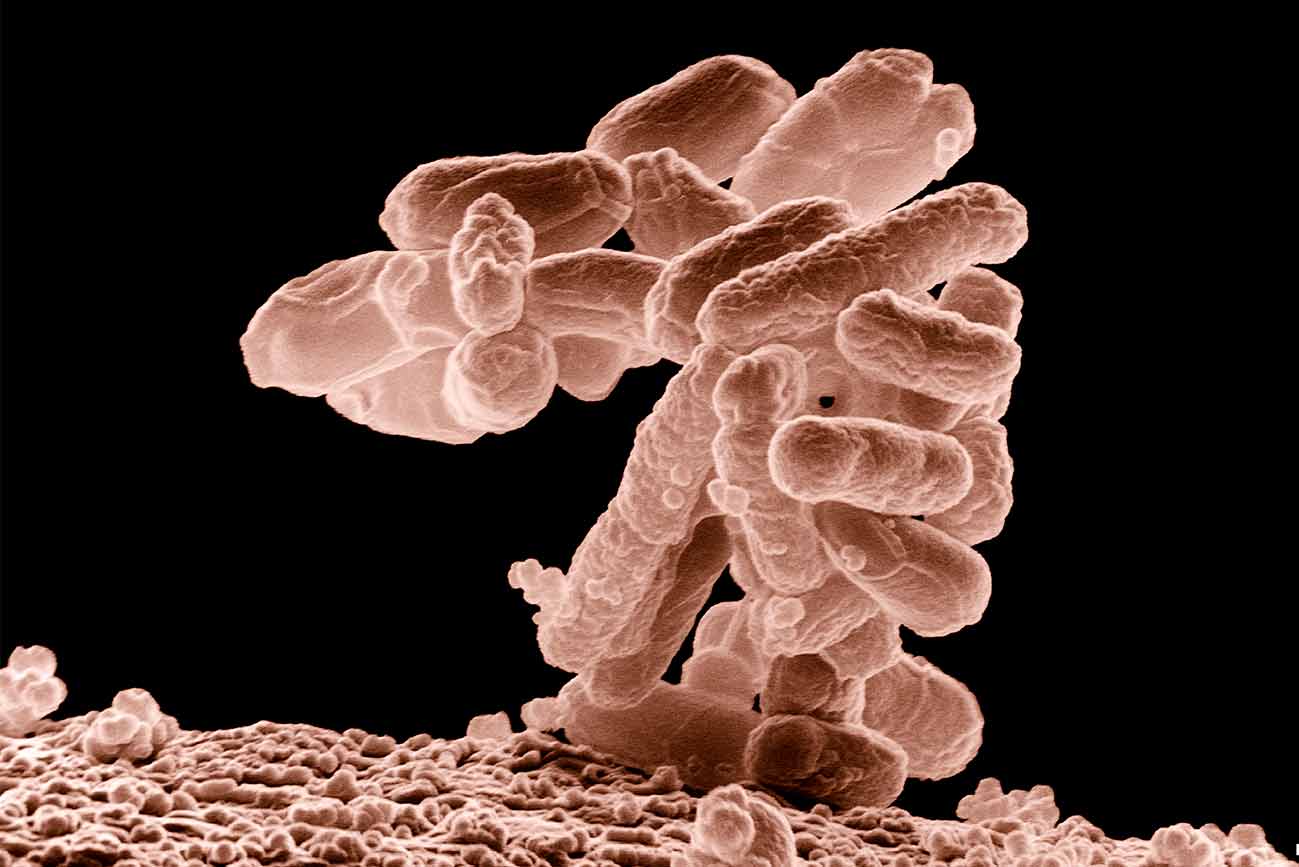 La bacteria E.Coli es una de las más frecuentes y resistentes a los antibióticos