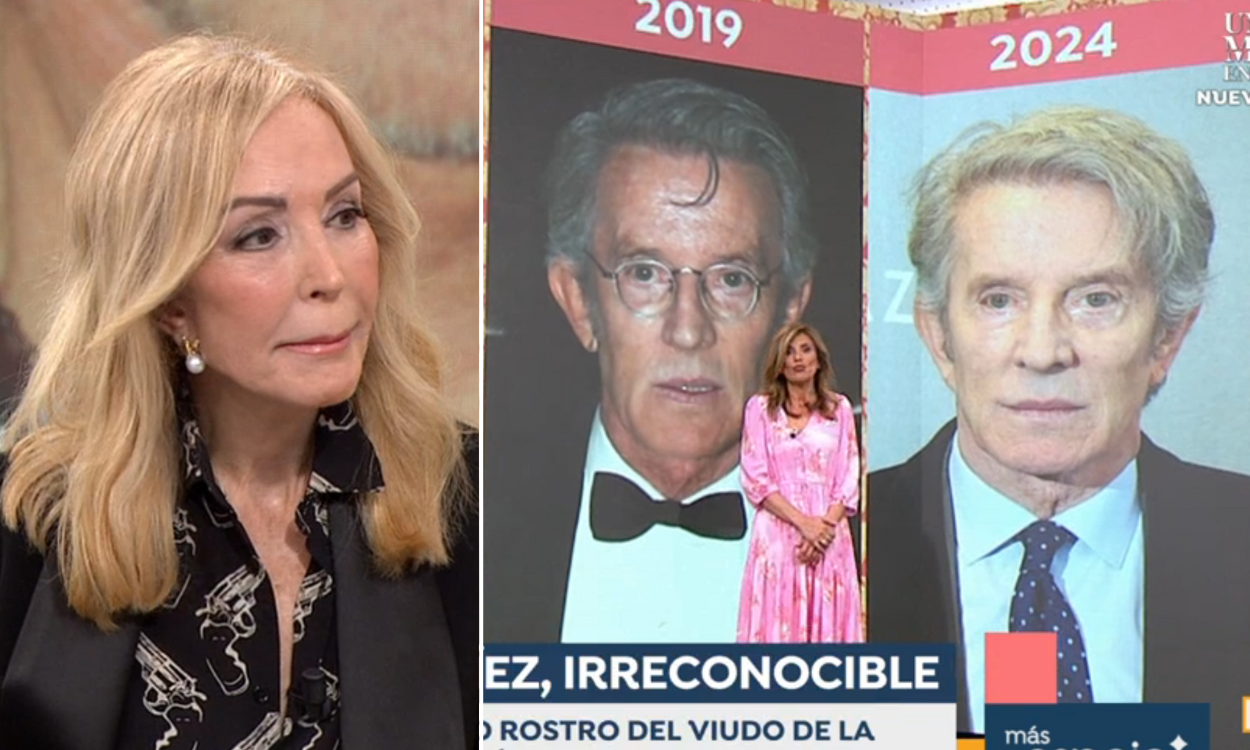 Carmen Lomana reacciona a la nueva cara de Alfonso Díez en 'Espejo Público'. Atresmedia Televisión