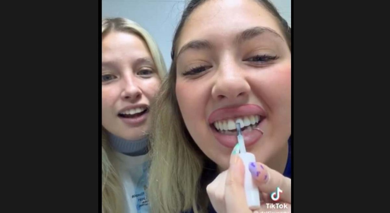 Las modas virales más peligrosas de las redes sociales para la salud dental