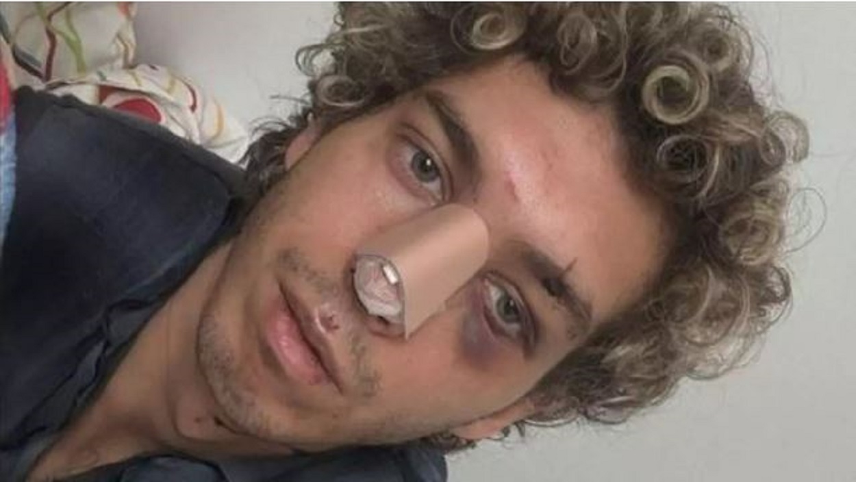 Manuel, una de las víctimas de la agresión homófoba. Instagram