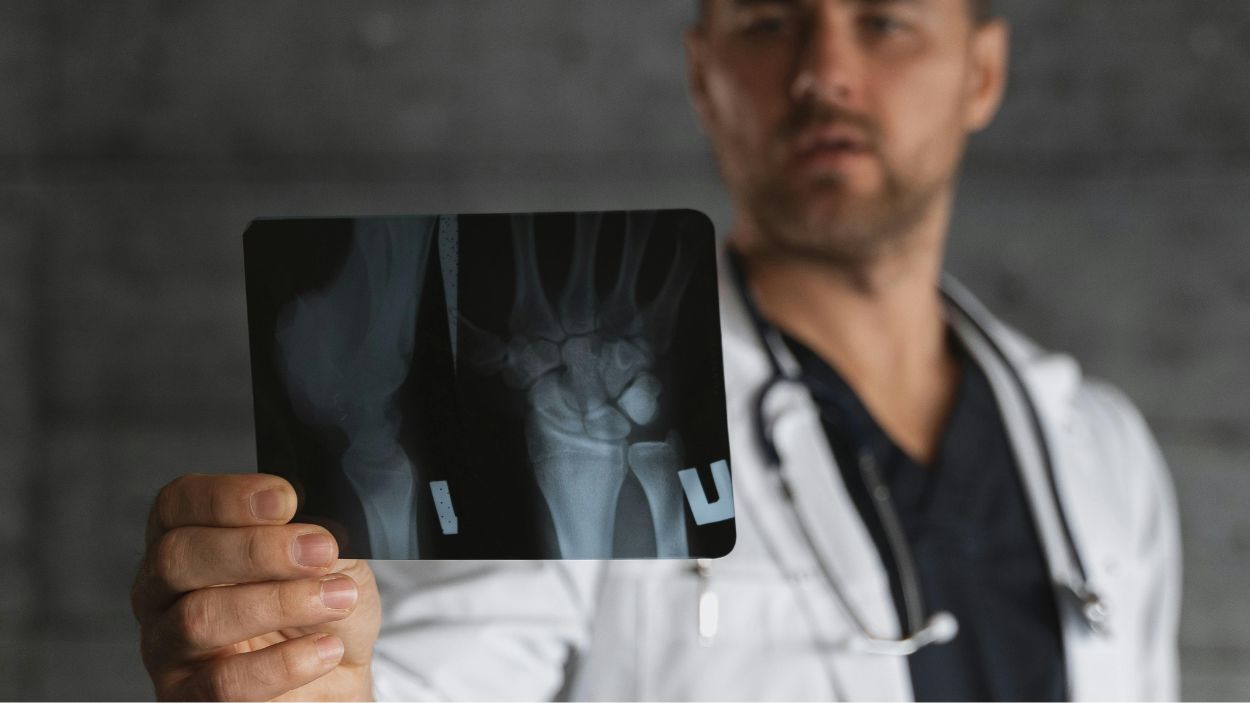 Más allá de la fractura cómo recuperar la vida tras romperse la cadera