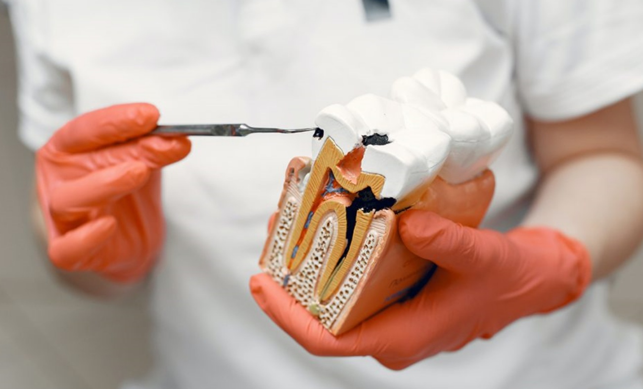 La pulpa de dientes y muelas del juicio contiene células madre con capacidad regenerativa