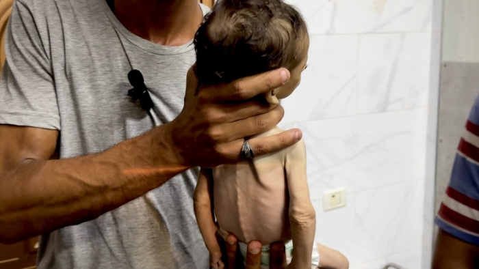 EuropaPress 6865799 20 july 2025 palestinian territories khan younis palestinian baby who died EuropaPress 6865799 20 july 2025 palestinian territories khan younis palestinian baby who died