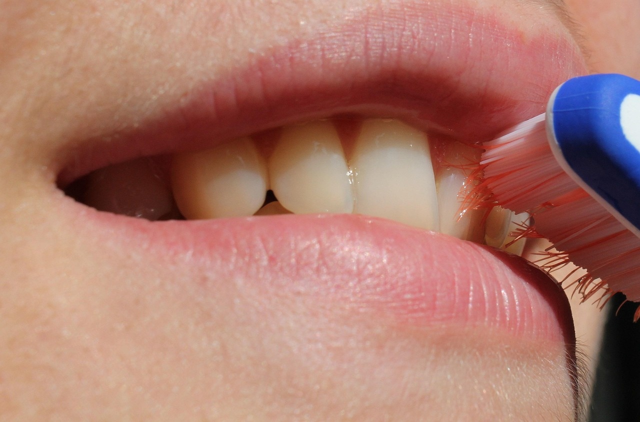 Aunque el cepillado de dientes es una práctica rutinaria, cometemos muchos errores al hacerlo. (Foto: Pixabay)