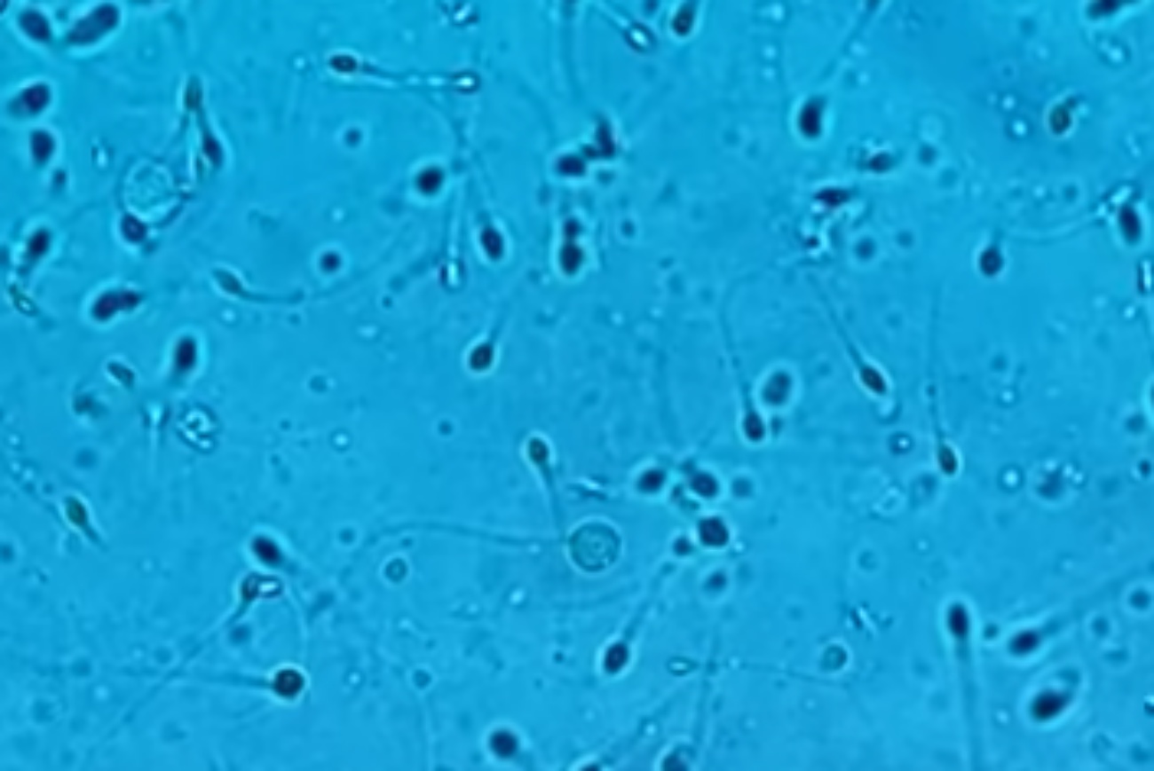 Espermatozoides vistos al microscopio