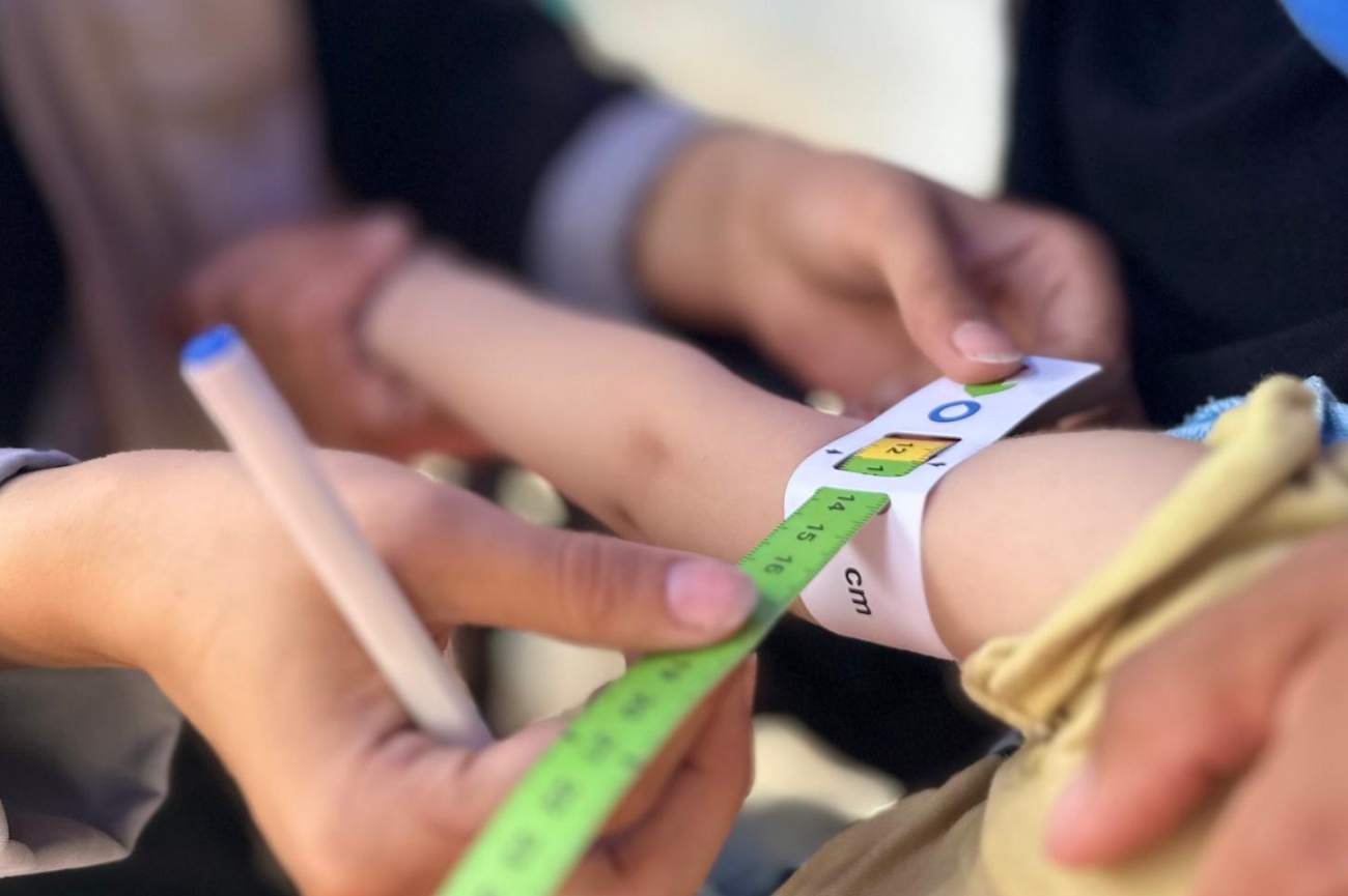 El número de niños con desnutrición aguda se ha multiplicado de forma exponencial en Gaza. (Foto: Aldeas Infantiles)