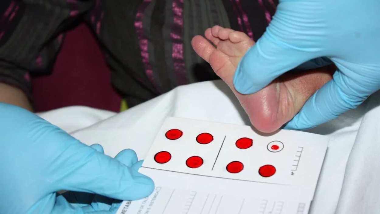 Un sanitario realiza la prueba del talón a un recién nacido. EP.