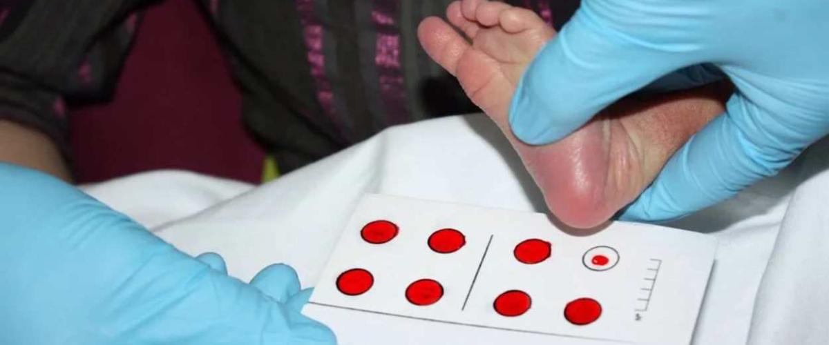 la prueba del talón vuelve a ser garantía de prevención en Castilla-La Mancha la prueba del talón vuelve a ser garantía de prevención en Castilla-La Mancha
