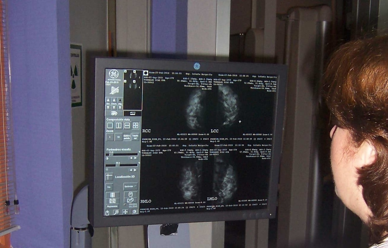 Imagen de una mamografía. (Foto. EP)