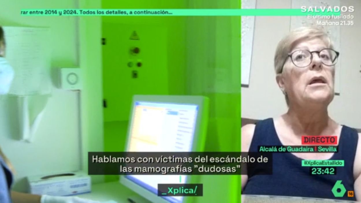 El desgarrador testimonio de una paciente andaluza con cáncer de mama “Me llamaron tarde y me cortaron el pecho”