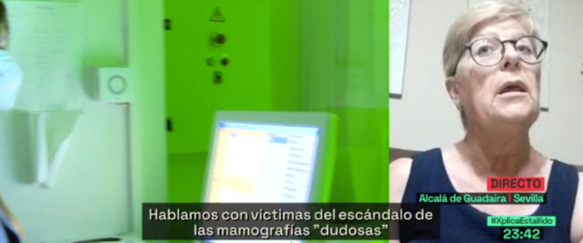 El desgarrador testimonio de una paciente andaluza con cáncer de mama: “Me llamaron tarde y me cortaron el pecho”