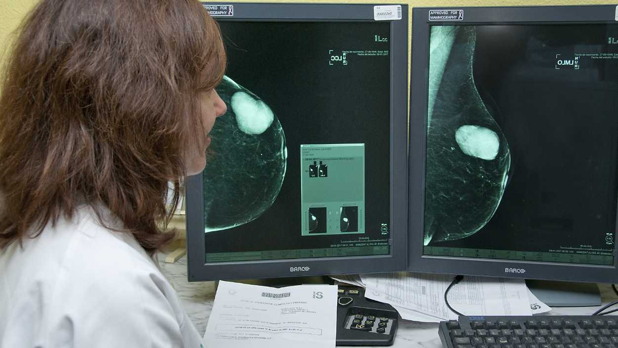 Una profesional del Servicio de Salud de Castilla La Mancha (SESCAM) inspecciona una mamografía. EP.