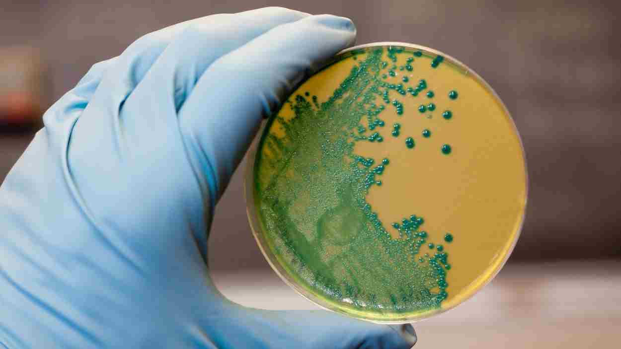 Listeria monocytogenes que crece en una placa de agar. EP.