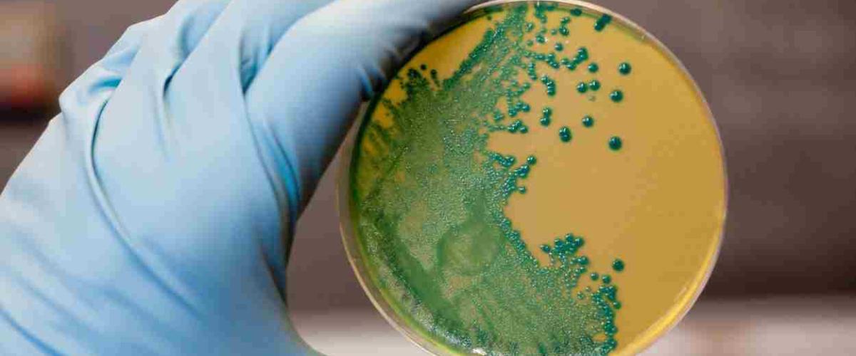Alerta sanitaria por listeria en un conocido chopped de supermercado Alerta sanitaria por listeria en un conocido chopped de supermercado