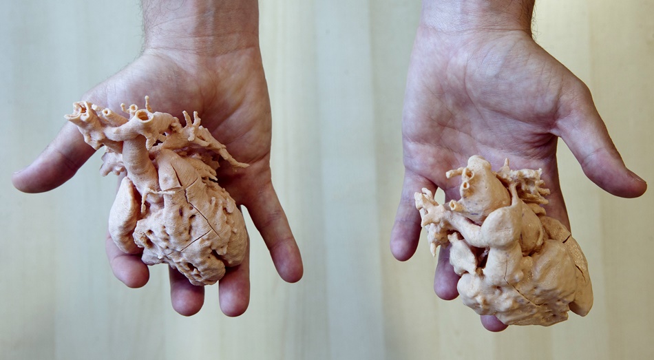 Imagen de dos corazones impresos a tamaño real en 3D para planificar su intervención en niños. 