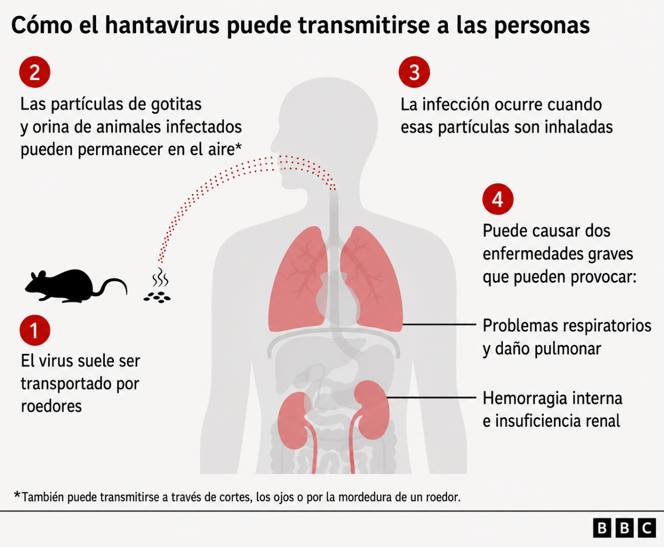 Traducción de infografía sobre el hantavirus publicada por la BBC. Traducción de infografía sobre el hantavirus publicada por la BBC.