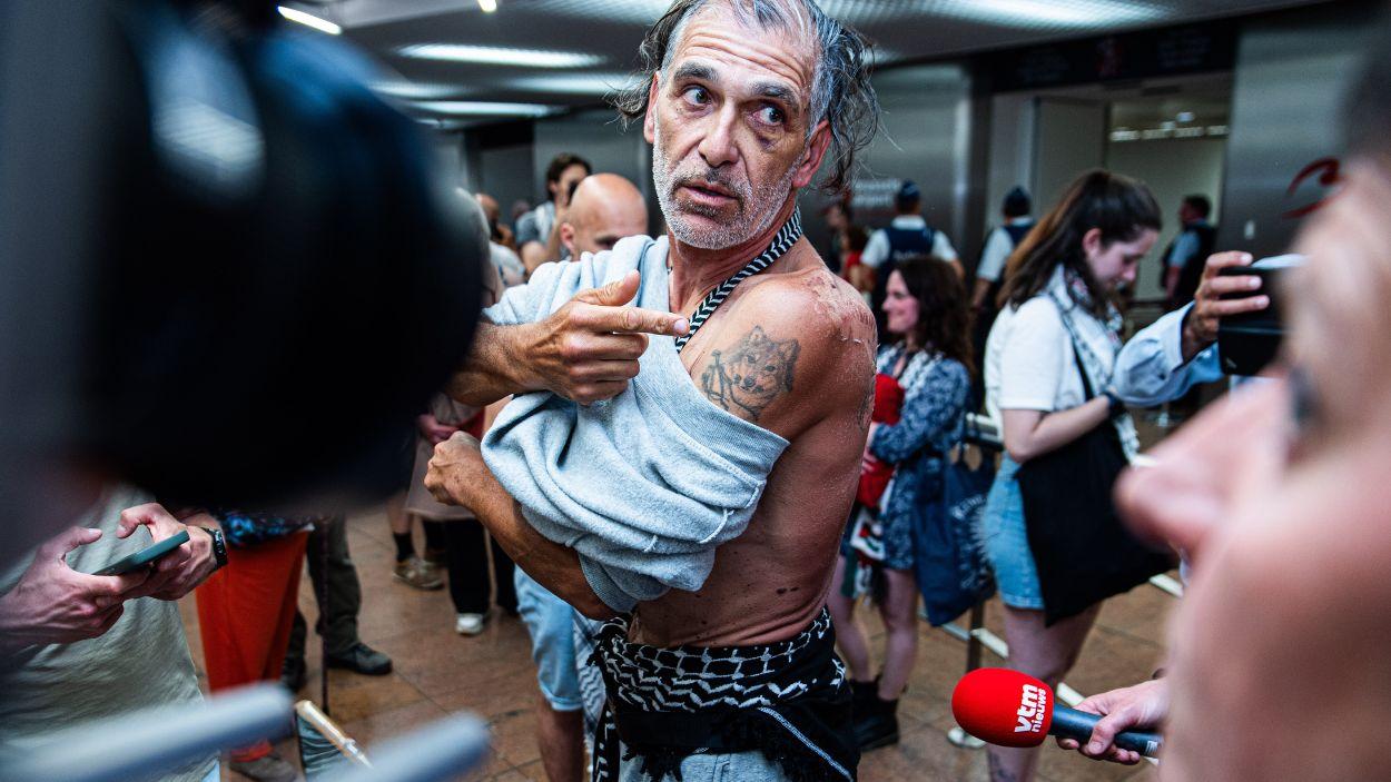 Un activista belga de la Flotilla a Gaza a su llegada al aeropuerto de Bruselas mostrando sus heridas. EP.