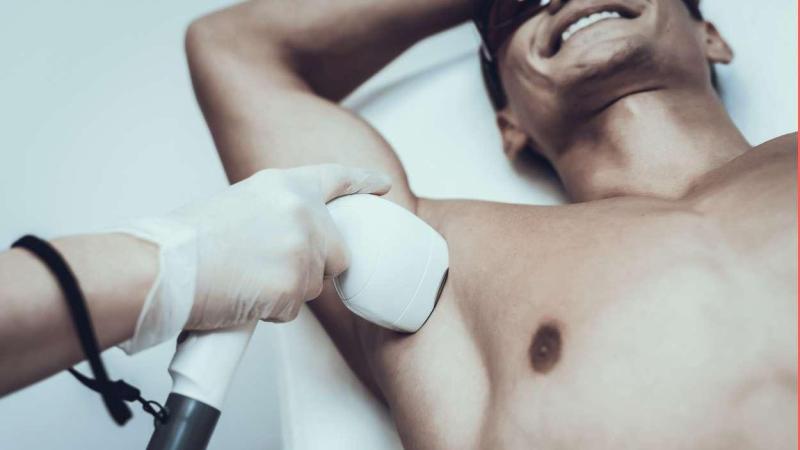Depilación láser masculina y las mejores ofertas del momento